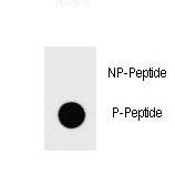 IKBKB / IKK2 / IKK Beta Antibody - Dot blot of Phospho-IKKB-S672 Antibody Phospho-specific antibody on nitrocellulose membrane. 50ng of Phospho-peptide or Non Phospho-peptide per dot were adsorbed. Antibody working concentrations are 0.6ug per ml.