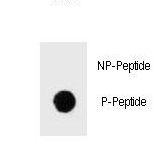 IKBKB / IKK2 / IKK Beta Antibody - Dot blot of Phospho-IKKB-S675 Antibody Phospho-specific antibody on nitrocellulose membrane. 50ng of Phospho-peptide or Non Phospho-peptide per dot were adsorbed. Antibody working concentrations are 0.6ug per ml.