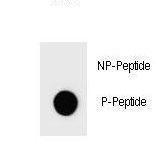 IKBKB / IKK2 / IKK Beta Antibody - Dot blot of Phospho-IKKB-S692 Antibody Phospho-specific antibody on nitrocellulose membrane. 50ng of Phospho-peptide or Non Phospho-peptide per dot were adsorbed. Antibody working concentrations are 0.6ug per ml.
