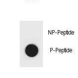 IKBKB / IKK2 / IKK Beta Antibody - Dot blot of mouse IKKB Antibody (Phospho S701) Phospho-specific antibody on nitrocellulose membrane. 50ng of Phospho-peptide or Non Phospho-peptide per dot were adsorbed. Antibody working concentrations are 0.6ug per ml.