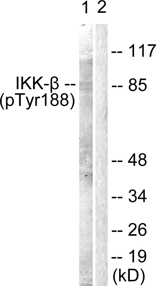 IKBKB / IKK2 / IKK Beta Antibody - Western blot analysis of lysates from COS7 cells, using IKK-beta (Phospho-Tyr188) Antibody. The lane on the right is blocked with the phospho peptide.