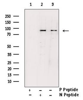 IKBKB / IKK2 / IKK Beta Antibody - Western blot analysis of Phospho-IKK beta (Tyr188) antibody expression in COS7 cells lysates. The lane on the right is treated with the antigen-specific peptide.