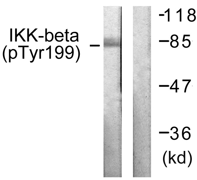IKBKB / IKK2 / IKK Beta Antibody - Western blot analysis of lysates from HeLa cells treated with TNF-a 20ng/ml+Calyculin A 50nM 5', using IKK-beta (Phospho-Tyr199) Antibody. The lane on the right is blocked with the phospho peptide.