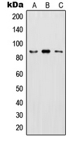 IKBKB / IKK2 / IKK Beta Antibody - Western blot analysis of IKK beta (pY199) expression in HeLa LPS-treated (A); Raw264.7 LPS-treated (B); PC12 LPS-treated (C) whole cell lysates.