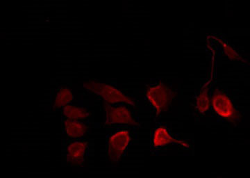 IKBKB / IKK2 / IKK Beta Antibody - Staining COS7 cells by IF/ICC. The samples were fixed with PFA and permeabilized in 0.1% Triton X-100, then blocked in 10% serum for 45 min at 25°C. The primary antibody was diluted at 1:200 and incubated with the sample for 1 hour at 37°C. An Alexa Fluor 594 conjugated goat anti-rabbit IgG (H+L) Ab, diluted at 1/600, was used as the secondary antibody.
