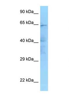 IKBKE / IKKI / IKKE Antibody - IKBKE antibody Western blot of HeLa Cell lysate. Antibody concentration 1 ug/ml.  This image was taken for the unconjugated form of this product. Other forms have not been tested.