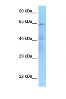 IKBKE / IKKI / IKKE Antibody - IKBKE antibody Western blot of HeLa Cell lysate. Antibody concentration 1 ug/ml.  This image was taken for the unconjugated form of this product. Other forms have not been tested.