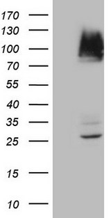 IKBKE / IKKI / IKKE Antibody - HEK293T cells were transfected with the pCMV6-ENTRY control. (Left lane) or pCMV6-ENTRY IKBKE. (Right lane) cDNA for 48 hrs and lysed. Equivalent amounts of cell lysates. (5 ug per lane) were separated by SDS-PAGE and immunoblotted with anti-IKBKE. (1:500)