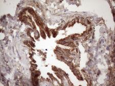 IKBKE / IKKI / IKKE Antibody - Immunohistochemical staining of paraffin-embedded Human lung tissue within the normal limits using anti-IKBKE mouse monoclonal antibody. (Heat-induced epitope retrieval by 1mM EDTA in 10mM Tris buffer. (pH8.5) at 120 oC for 3 min. (1:150)