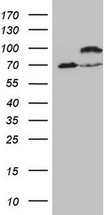IKBKE / IKKI / IKKE Antibody - HEK293T cells were transfected with the pCMV6-ENTRY control. (Left lane) or pCMV6-ENTRY IKBKE. (Right lane) cDNA for 48 hrs and lysed. Equivalent amounts of cell lysates. (5 ug per lane) were separated by SDS-PAGE and immunoblotted with anti-IKBKE. (1:2000)