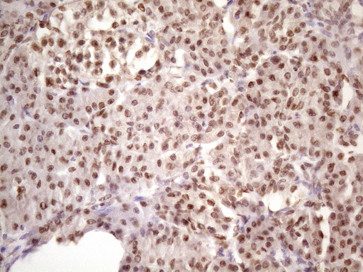IKBKE / IKKI / IKKE Antibody - Immunohistochemical staining of paraffin-embedded Human pancreas tissue within the normal limits using anti-IKBKE mouse monoclonal antibody. (Heat-induced epitope retrieval by 1 mM EDTA in 10mM Tris, pH8.5, 120C for 3min. (1:150)