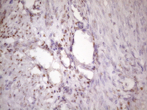 IKBKE / IKKI / IKKE Antibody - Immunohistochemical staining of paraffin-embedded Human endometrium tissue within the normal limits using anti-IKBKE mouse monoclonal antibody. (Heat-induced epitope retrieval by 1 mM EDTA in 10mM Tris, pH8.5, 120C for 3min. (1:150)