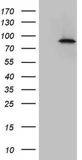 IKBKE / IKKI / IKKE Antibody - HEK293T cells were transfected with the pCMV6-ENTRY control. (Left lane) or pCMV6-ENTRY IKBKE. (Right lane) cDNA for 48 hrs and lysed