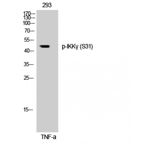 IKBKG / NEMO / IKK Gamma Antibody - Western blot of Phospho-IKKgamma (S31) antibody
