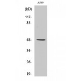 IKBKG / NEMO / IKK Gamma Antibody - Western blot of IKKgamma antibody