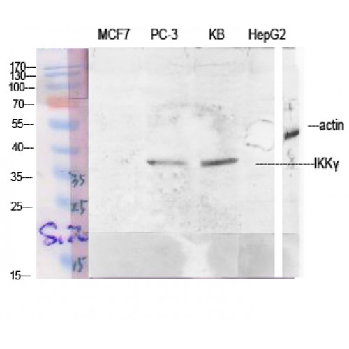 IKBKG / NEMO / IKK Gamma Antibody - Western blot of IKKgamma antibody