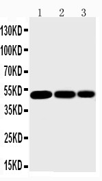 IKBKG / NEMO / IKK Gamma Antibody - WB of IKBKG / NEMO / IKK Gamma antibody. All lanes: Anti-IKBKG at 0.5ug/ml. Lane 1: Mouse Liver Tissue Lysate at 40ug. Lane 2: Mouse Brain Tissue Lysate at 40ug. Lane 3: Mouse Ovary Tissue Lysate at 40ug. Predicted bind size: 48KD. Observed bind size: 48KD.