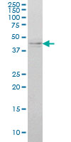 IKBKG / NEMO / IKK Gamma Antibody - IKBKG monoclonal antibody (M01), clone 4G9 Western blot of IKBKG expression in K-562.