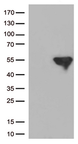 IKBKG / NEMO / IKK Gamma Antibody - HEK293T cells were transfected with the pCMV6-ENTRY control. (Left lane) or pCMV6-ENTRY IKBKG. (Right lane) cDNA for 48 hrs and lysed. Equivalent amounts of cell lysates. (5 ug per lane) were separated by SDS-PAGE and immunoblotted with anti-IKBKG. (1:500)