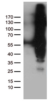 IKBKG / NEMO / IKK Gamma Antibody - HEK293T cells were transfected with the pCMV6-ENTRY control. (Left lane) or pCMV6-ENTRY IKBKG. (Right lane) cDNA for 48 hrs and lysed. Equivalent amounts of cell lysates. (5 ug per lane) were separated by SDS-PAGE and immunoblotted with anti-IKBKG. (1:500)