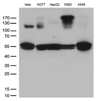 IKBKG / NEMO / IKK Gamma Antibody - Western blot analysis of extracts. (35ug) from 5 cell lines lysates by using anti-IKBKG monoclonal antibody. (1:500)