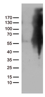IKBKG / NEMO / IKK Gamma Antibody - HEK293T cells were transfected with the pCMV6-ENTRY control. (Left lane) or pCMV6-ENTRY IKBKG. (Right lane) cDNA for 48 hrs and lysed