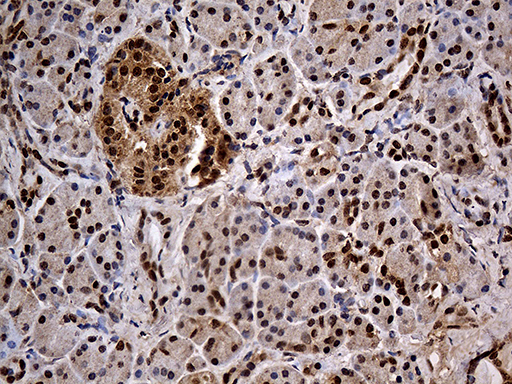 IKBKG / NEMO / IKK Gamma Antibody - Immunohistochemical staining of paraffin-embedded Human pancreas tissue within the normal limits using anti-IKBKG mouse monoclonal antibody. (Heat-induced epitope retrieval by 1mM EDTA in 10mM Tris buffer. (pH8.5) at 120°C for 3 min. (1:500)