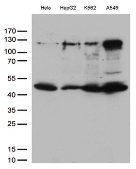 IKBKG / NEMO / IKK Gamma Antibody - Western blot analysis of extracts. (35ug) from 4 cell lines lysates by using anti-IKBKG monoclonal antibody. (1:500)