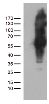 IKBKG / NEMO / IKK Gamma Antibody - HEK293T cells were transfected with the pCMV6-ENTRY control. (Left lane) or pCMV6-ENTRY IKBKG. (Right lane) cDNA for 48 hrs and lysed