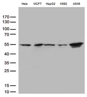 IKBKG / NEMO / IKK Gamma Antibody - Western blot analysis of extracts. (35ug) from 5 cell lines lysates by using anti-IKBKG monoclonal antibody. (1:500)