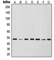 IKBKG / NEMO / IKK Gamma Antibody - Western blot analysis of IKK gamma expression in Jurkat (A); HL60 (B); HeLa (C); NIH3T3 (D); Raw264.7 (E); PC12 (F); rat heart (G) whole cell lysates.