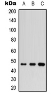 IKBKG / NEMO / IKK Gamma Antibody - Western blot analysis of IKK gamma expression in HepG2 (A); PC3 (B); Raw264.7 (C) whole cell lysates.