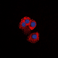 IKBKG / NEMO / IKK Gamma Antibody - Immunofluorescent analysis of IKK gamma staining in HepG2 cells. Formalin-fixed cells were permeabilized with 0.1% Triton X-100 in TBS for 5-10 minutes and blocked with 3% BSA-PBS for 30 minutes at room temperature. Cells were probed with the primary antibody in 3% BSA-PBS and incubated overnight at 4 ??C in a humidified chamber. Cells were washed with PBST and incubated with a DyLight 594-conjugated secondary antibody (red) in PBS at room temperature in the dark. DAPI was used to stain the cell nuclei (blue).