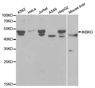 IKBKG / NEMO / IKK Gamma Antibody - Western blot analysis of extracts of various cell lines, using IKBKG antibody.