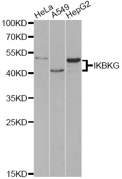IKBKG / NEMO / IKK Gamma Antibody - Western blot analysis of extracts of various cell lines, using IKBKG antibody at 1:1000 dilution. The secondary antibody used was an HRP Goat Anti-Rabbit IgG (H+L) at 1:10000 dilution. Lysates were loaded 25ug per lane and 3% nonfat dry milk in TBST was used for blocking.