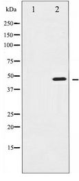 IKBKG / NEMO / IKK Gamma Antibody - Western blot of IKK-gamma expression in 293 whole cell lysates,The lane on the left is treated with the antigen-specific peptide.