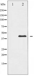 IKBKG / NEMO / IKK Gamma Antibody - Western blot of IKK- gamma expression in Anisomycin treated HepG2 whole cell lysates,The lane on the left is treated with the antigen-specific peptide.
