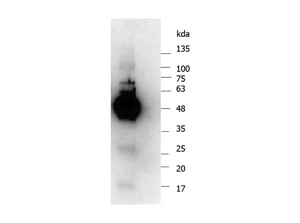 IKBKG / NEMO / IKK Gamma Antibody - Western Blot of rabbit anti-NEMO antibody. Lane 1: Opal Pre-stained ladder Lane 2: Recombinant NEMO protein. Load: 175 ng per lane. Primary antibody: NEMO antibody at 1:1,000 for overnight at 4°C. Secondary antibody: Peroxidase rabbit secondary antibody at 1:70,000 for 30 min at RT. Blocking Buffer: MB-070 for 30 min at RT. Predicted/Observed size: 55 and 47 kDa for NEMO.