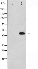 IKBKG / NEMO / IKK Gamma Antibody - Western blot analysis of IKK-gamma expression in 293 cells. The lane on the left is treated with the antigen-specific peptide.