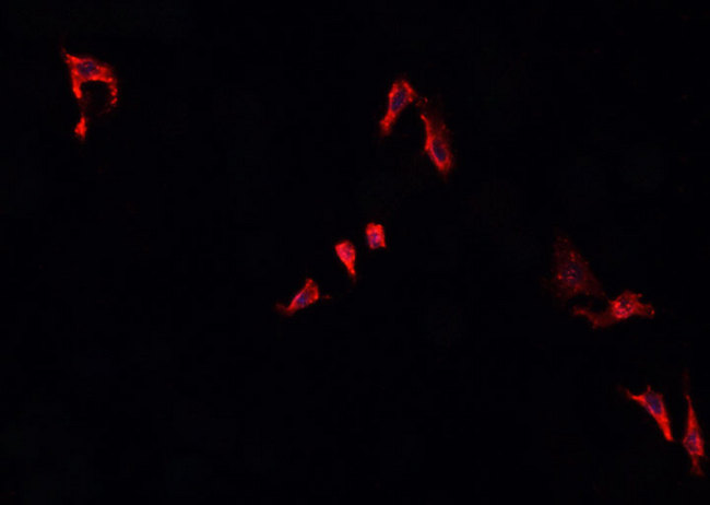 IKBKG / NEMO / IKK Gamma Antibody - Staining 293 cells by IF/ICC. The samples were fixed with PFA and permeabilized in 0.1% Triton X-100, then blocked in 10% serum for 45 min at 25°C. The primary antibody was diluted at 1:200 and incubated with the sample for 1 hour at 37°C. An Alexa Fluor 594 conjugated goat anti-rabbit IgG (H+L) Ab, diluted at 1/600, was used as the secondary antibody.