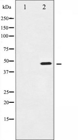 IKBKG / NEMO / IKK Gamma Antibody - Western blot analysis of IKK-gamma expression in 293 whole cells lysates. The lane on the left is treated with the antigen-specific peptide.