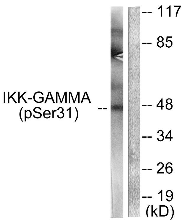 IKBKG / NEMO / IKK Gamma Antibody - Western blot analysis of lysates from 293 cells treated with TNF-a 20ng/ml 5', using IKK-gamma (Phospho-Ser31) Antibody. The lane on the right is blocked with the phospho peptide.