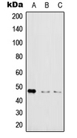IKBKG / NEMO / IKK Gamma Antibody - Western blot analysis of IKK gamma (pS31) expression in HeLa LPS-treated (A); Raw264.7 LPS-treated (B); rat brain (C) whole cell lysates.