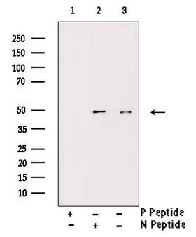 IKBKG / NEMO / IKK Gamma Antibody - Western blot analysis of Phospho-IKK gamma (Ser31) antibody expression in TNF-a treated 293 cells lysates. The lane on the right is treated with the antigen-specific peptide.