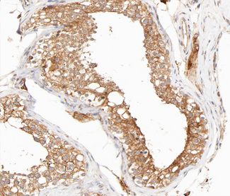 IKBKG / NEMO / IKK Gamma Antibody - 1:200 staining human Testis tissue by IHC-P. The tissue was formaldehyde fixed and a heat mediated antigen retrieval step in citrate buffer was performed. The tissue was then blocked and incubated with the antibody for 1.5 hours at 22°C. An HRP conjugated goat anti-rabbit antibody was used as the secondary.