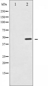 IKBKG / NEMO / IKK Gamma Antibody - Western blot analysis of IKK-gamma phosphorylation expression in TNF-a treated 293 whole cells lysates. The lane on the left is treated with the antigen-specific peptide.