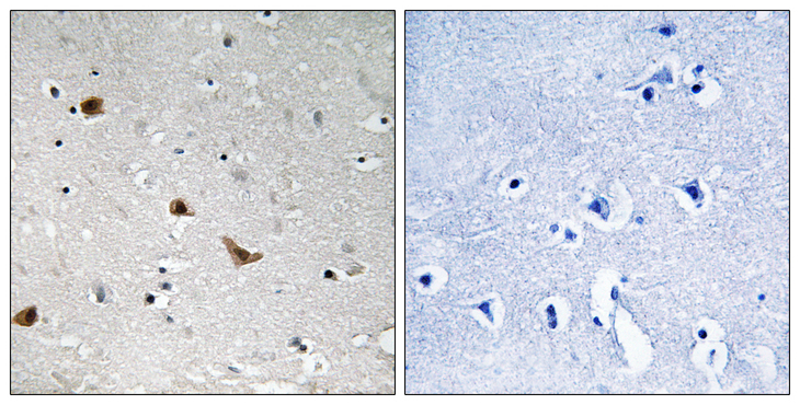 IKBKG / NEMO / IKK Gamma Antibody - Immunohistochemistry analysis of paraffin-embedded human brain, using IKK-gamma (Phospho-Ser376) Antibody. The picture on the right is blocked with the phospho peptide.