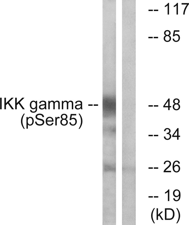 IKBKG / NEMO / IKK Gamma Antibody - Western blot analysis of lysates from HepG2 cells treated with Anisomycin 0.5uM 5h, using IKK-gamma (Phospho-Ser85) Antibody. The lane on the right is blocked with the phospho peptide.