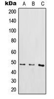 IKBKG / NEMO / IKK Gamma Antibody - Western blot analysis of IKK gamma (pS85) expression in THP1 LPS-treated (A); Raw264.7 LPS-treated (B); rat brain (C) whole cell lysates.