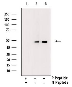 IKBKG / NEMO / IKK Gamma Antibody - Western blot analysis of Phospho-IKK (Ser85) antibody expression in Anisomycin treated HepG2 cells lysates. The lane on the right is treated with the antigen-specific peptide.